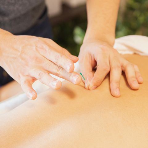 דיקור סיני לטיפול בבעיות בריאותיות שונות